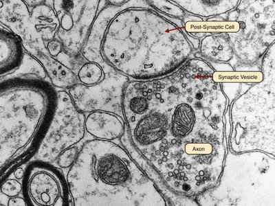 Electron micrograph of synapse showing synaptic vesicles and postsynaptic cell