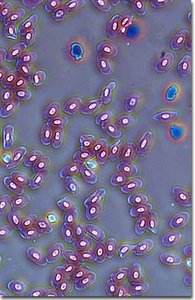 Frog blood cells with visible nuclei