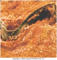 Cilia in the respiratory tract