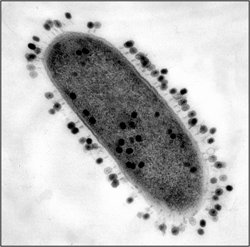 Bacteriophages infecting a bacterial cell