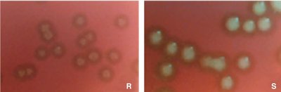 Colony morphology of R and S strains of Streptococcus pneumoniae