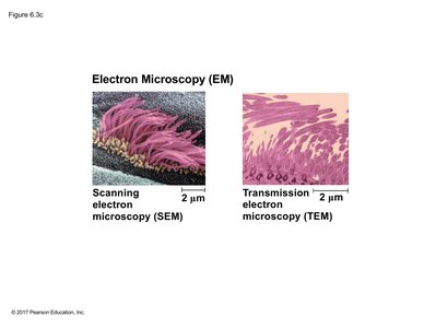 SEM and TEM images of cells