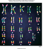 Human karyotype with chromosome pairs