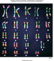 Human karyotype with chromosome pairs
