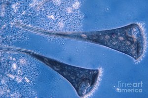 Trumpet-shaped protists (Stentor coeruleus)