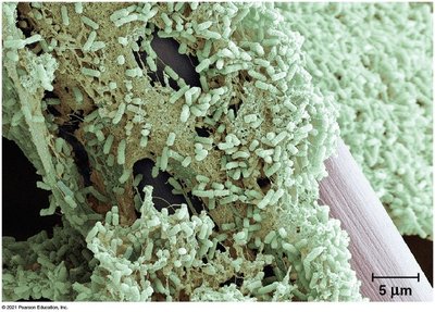 Pseudomonas forming a biofilm