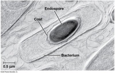 Bacterial endospore within a cell