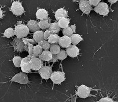 Bacterial colony forming biofilm