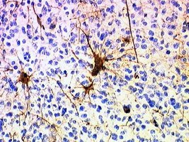 Histological image of glial cells among neurons