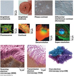 Types of microscopy
