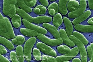 Another microscopic image of bacteria