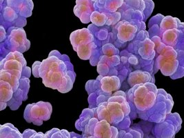 Microscopic image of archaea