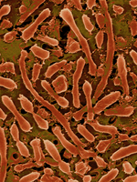 Another microscopic image of archaea