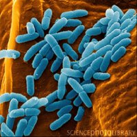 Microscopic image of bacteria