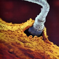 Sperm entering ovum