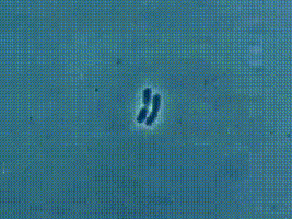 Mitosis under microscope