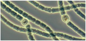 Filaments of Anabaena with heterocysts