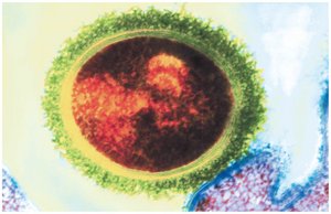 Bacterial capsule surrounding cell wall