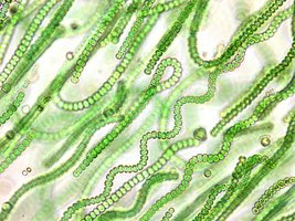 Microscopic image of cyanobacteria filaments