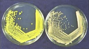 Streak plate with isolated bacterial colonies
