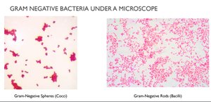 Gram negative bacteria under a microscope