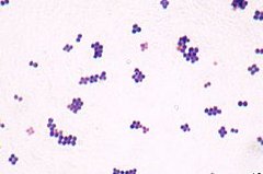 Gram-stained cocci under the microscope