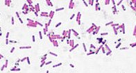 Gram-stained bacilli under the microscope