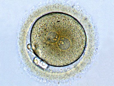 Fertilized egg cell