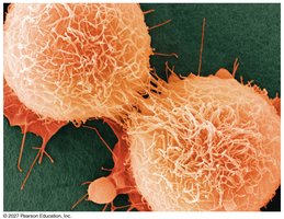HeLa cancer cells