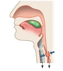 Diagram of swallowing with esophageal sphincter and epiglottis