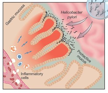 Stomach lining and mucus protection