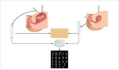 Karyotyping and fetal testing