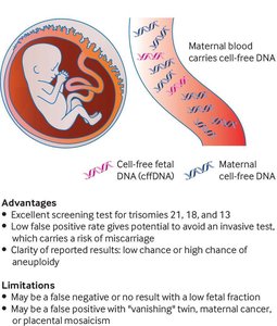 Noninvasive prenatal testing (NIPT)