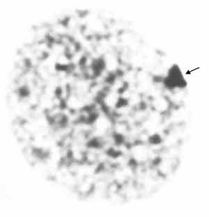 Barr body in cell nucleus