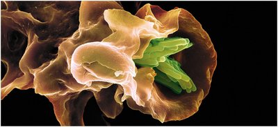 Macrophage engulfing Mycobacterium tuberculosis