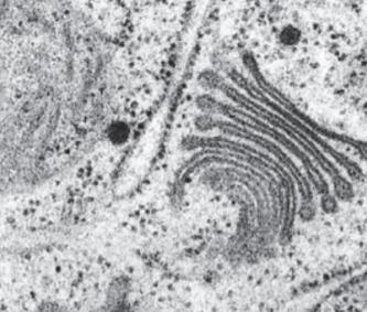 Electron micrograph of Golgi apparatus