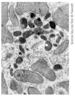Electron micrograph of mitochondrion