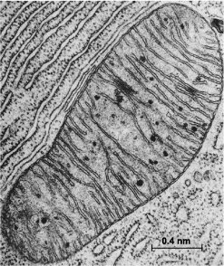 Electron micrograph of chloroplast