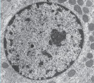 Electron micrograph of nucleus