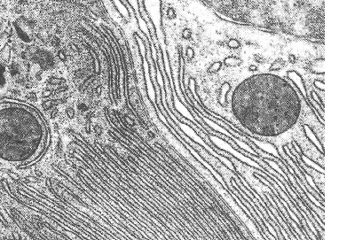 Electron micrograph of ER