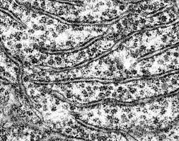 Electron micrograph of ribosomes on ER