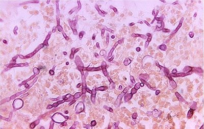 Microscopic view of fungal hyphae