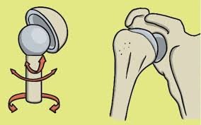 Ball and socket joint diagram