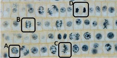 onion root tip mitosis stages