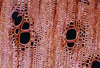 Microscopic image of plant vascular tissue