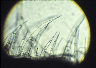 Microscopic image of root hairs