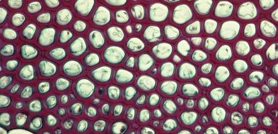 Microscopic image of plant tissue with round cells