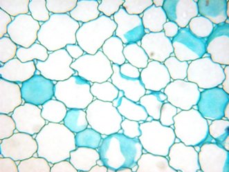 Microscopic image of plant tissue with large, loosely packed cells