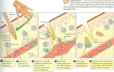 Diagram of the inflammatory response