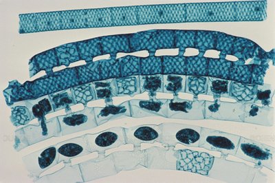 Spirogyra cell diagram showing vegetative cell, chloroplasts, and nucleus